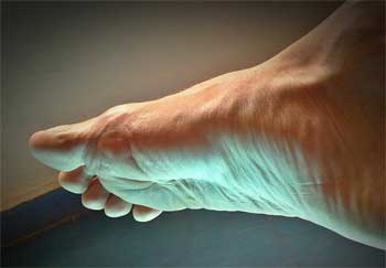 Foot Pain